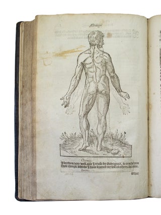 Bulleins bulwarke of defece againste all sicknes, sornes, and woundes